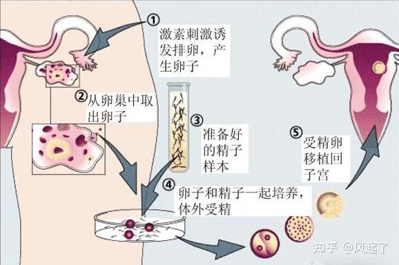 供卵是违法的吗(供卵合法化:是违法的吗?)