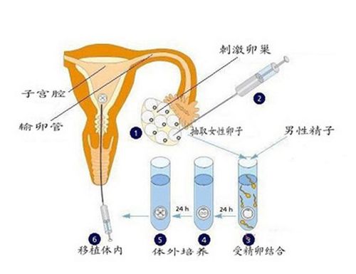 供卵机构是真的吗-供卵机构是真的吗？揭秘供卵机构的真相
