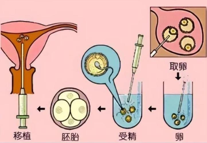 供卵的孩子跟母体有血缘关系吗【供卵孩子与母体是否有血缘关系?】